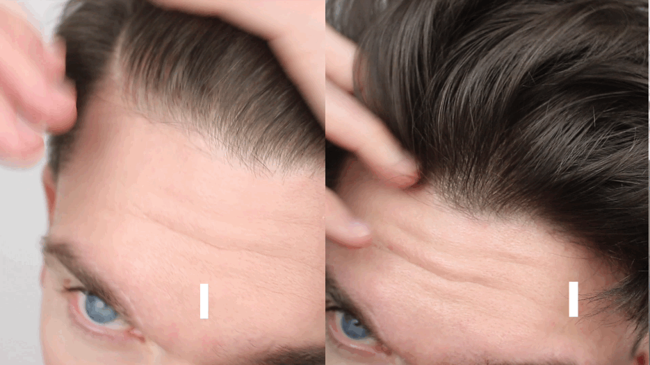 nioxin-before-after-gif