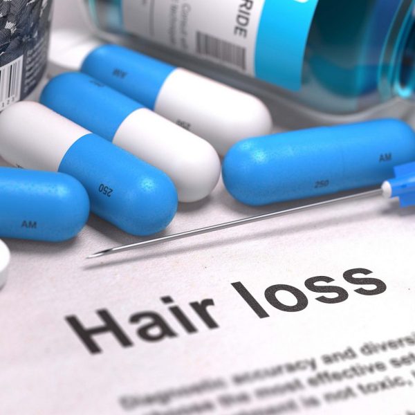 hair-loss-treatments-man-for-himself