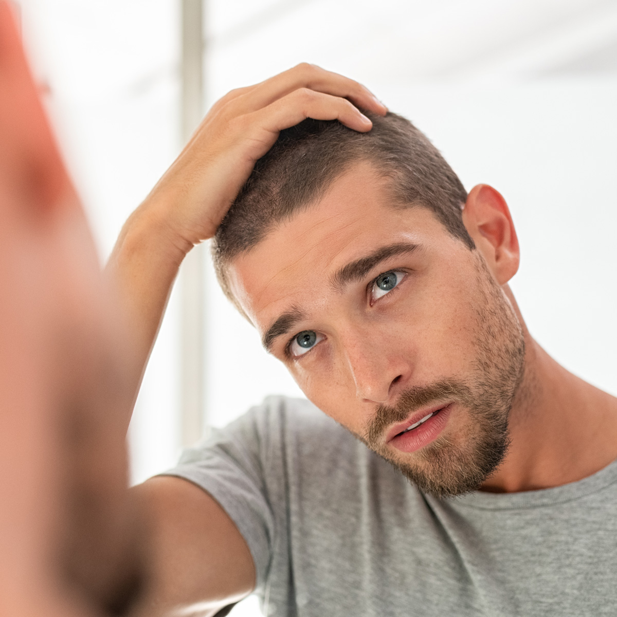 Hair Loss Treatments Explained | Minoxidil, Finasteride, Biotin, DHT  Blocking - Man For Himself