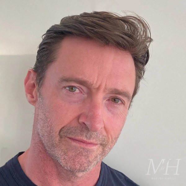 Hugh Jackman: Thinning Hairstyle